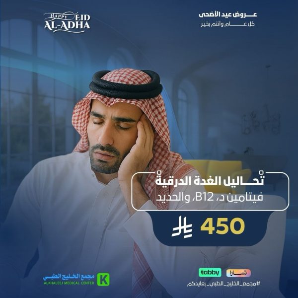 باقة الخمول العام